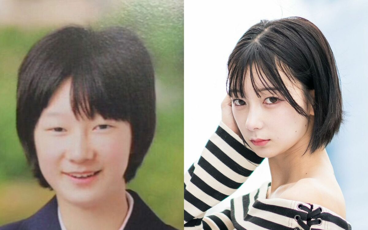 あなたの鼻はどんな鼻？👃 〜お悩み別・症例紹介〜 お悩み💡 ・あぐら鼻 ・にんにく鼻 ・団子鼻 ・豚鼻 詳しくは投稿をご覧ください🙌鼻先が気になるからと言って 「鼻尖形成」「鼻翼縮小」だけをするのが いいとは限りません✨ ロジックビューティークリニックでは