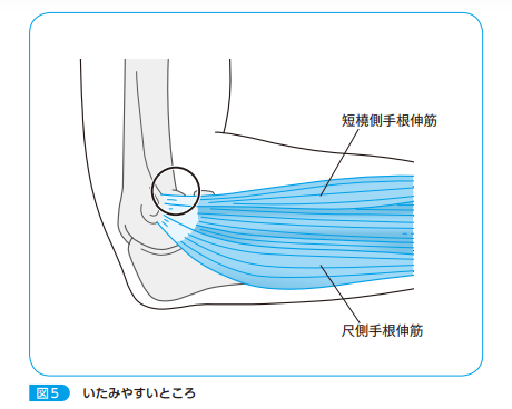 肩と肘の痛み 永井 宏和 肩や肘 の疾患は、気づかないうちに進行していることがよくあります。少しでも気になる症状があれば、早めに専門医にかかることが大切です