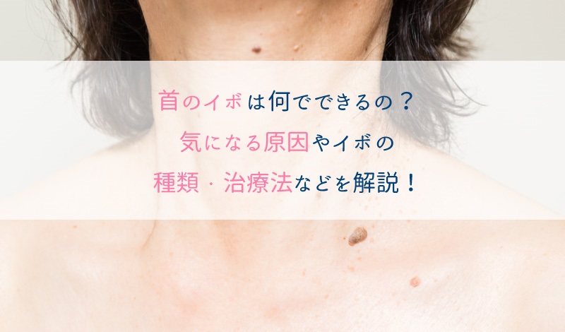 首のイボは液体窒素で取る？いぼの種類とやってはいけない取り方