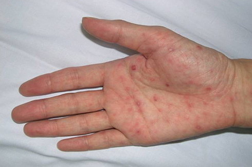 これって、性感染症？HIV検査・相談マップ