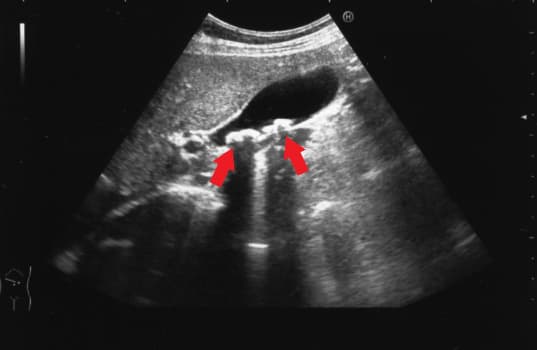 エコー検査 超音波検査- ほりもと内科消化器クリニック 公式