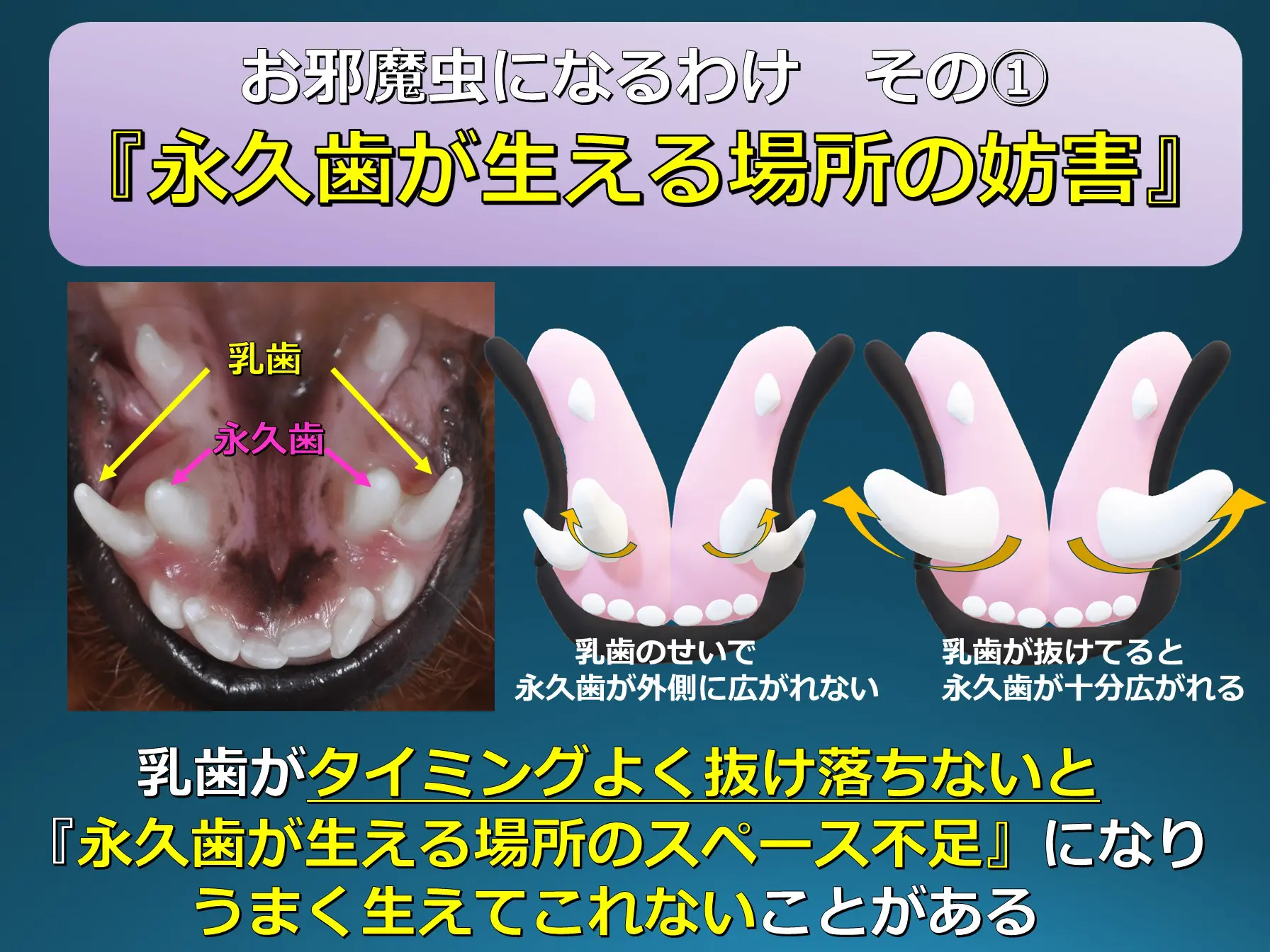 インターホン 無線 ワイヤレス ドアホン 工事不要 防水 チャイム 門柱 ワイヤレス距離 玄関 音量調整 電池式 電源不要 お風呂 選べるカラー :NaNatol - 通販 - Yahoo!ショッピング