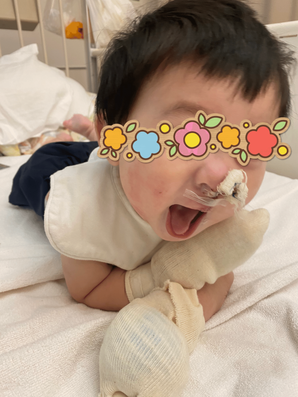 口唇口蓋裂の手術治療後のケアと東京都立小児総合医療センターのチーム医療メディカルノート