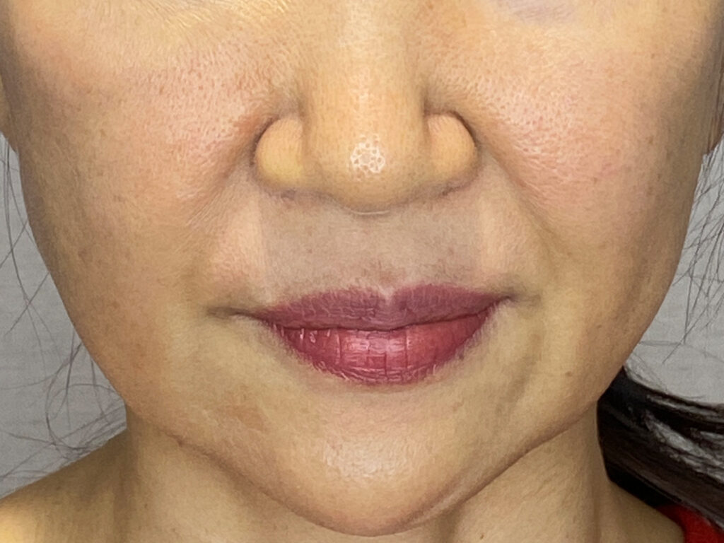 スパトリートメント HAS ストレッチアイシート 目元パック・ほうれい線パック 60枚