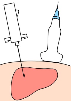 生検イラスト無料イラスト・フリー素材なら「イラストAC」