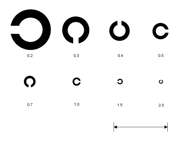 視力検査でぼんやりとしか見えていないときは「わからない」と答えた方がいいですか？瞳のギモンアキュビュー®公式