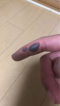 巻き爪による痛みや血豆―つらい症状、お仕事にも影響していませんか？巻き爪・フットケア＆ネイルサロンmignonのニュースまいぷれ 三島