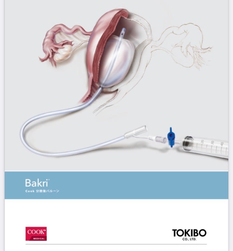 妊娠41週で第一子の女の子を出産。予定日超過、誘発入院、緊急帝王切開 と予想外の出来事が連発の出産に夫婦で泣く たまひよ 出産体験談たまひよ