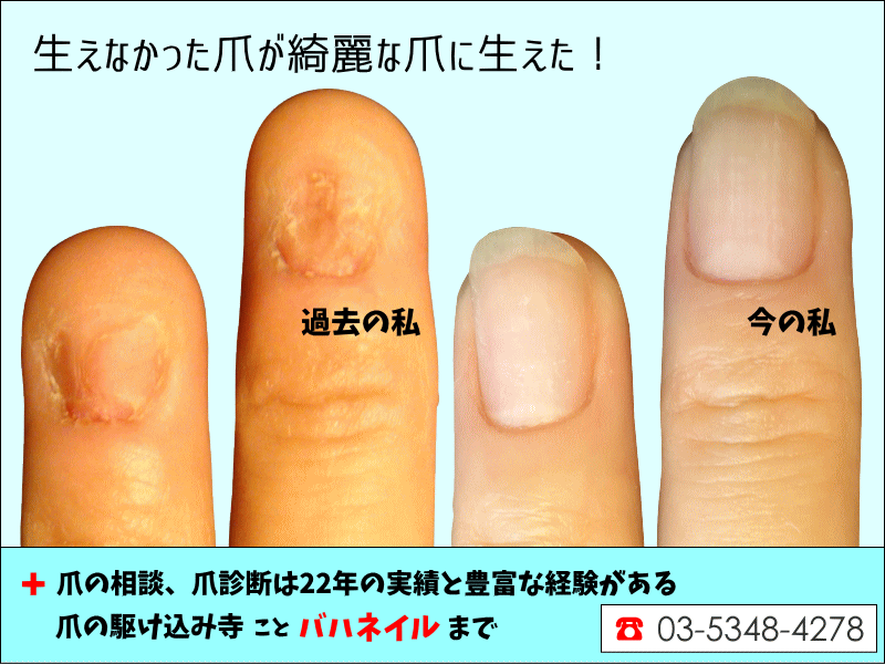 爪が薄い ジェルネイルを休むべき？冬に多い爪からのSOSサイン2024