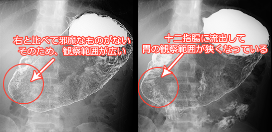 消化管閉塞 犬猫のバリウム検査〜消化管閉塞を探し出す〜 - HALU代官山動物病院渋谷、渋谷駅・恵比寿・代官山