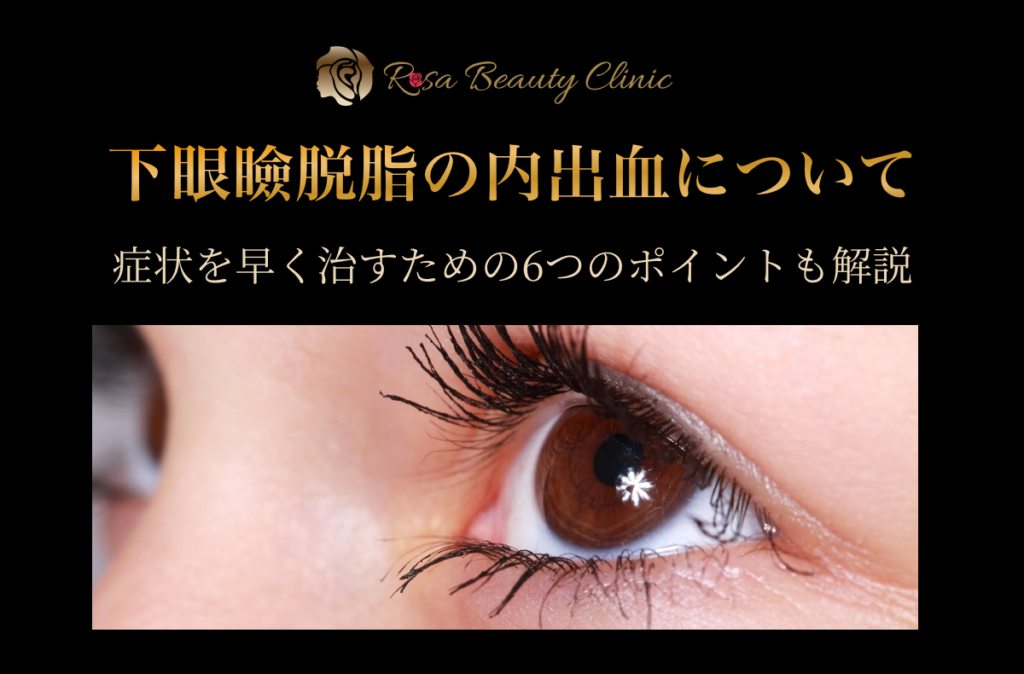 二重整形による内出血の原因と対処法 – 早く治す方法と上手に隠すコツアリエル美容クリニック 大宮院