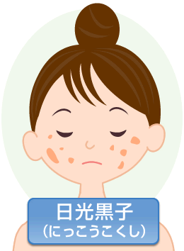 子どもの頬の黒ずみで検索する - ヒヨコ母さんの子育て術