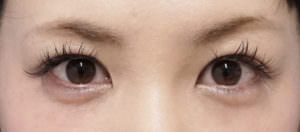 デカ目を手に入れよう！短時間でできる目元マッサージ法