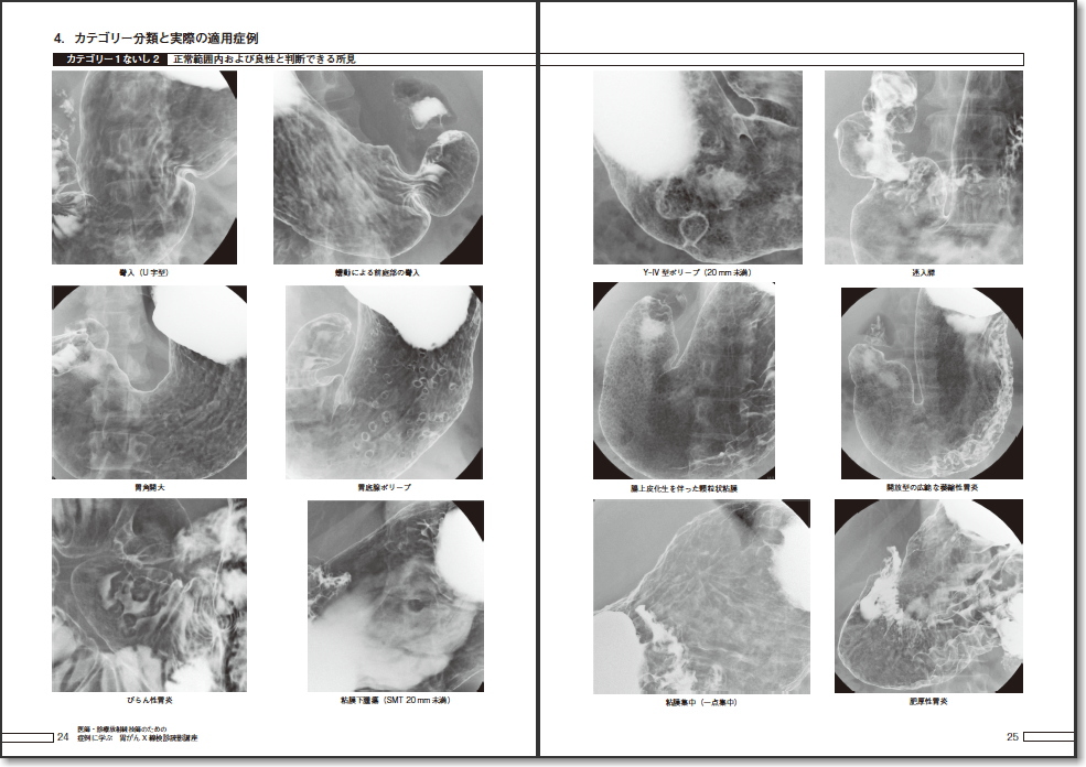 星総合病院 X線透視検査