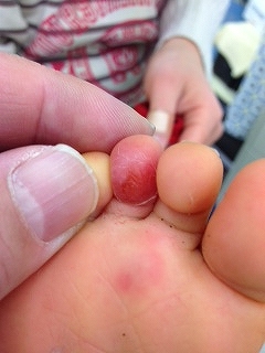 ＼寝ている時の赤ちゃんの手足が冷たいときの対策は？ , 大人は末端冷え性などで寝ているとき手足が冷たくなることがあります。,赤ちゃんがそうなってしまった場合はどうすればよいのでしょうか？, 今回は赤ちゃんの睡眠時の手の冷たさについて解説します💡,不安を解消して、赤ちゃんと健やかな日々を過ごしましょう🌱,, MEDI+SKIN メディスキン 公式アカウントでは、,