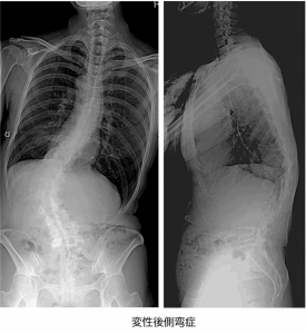 Amazon首気管カバー 首ストーマプロテクター 傷隠し 調節可能 ソフト 通気性 洗濯可能 男女兼用 シャワーカバーストーマ防塵プロテクターカバー 喉頭摘出術気管切開用 2枚セットホワイトHaixifry首・頸椎用