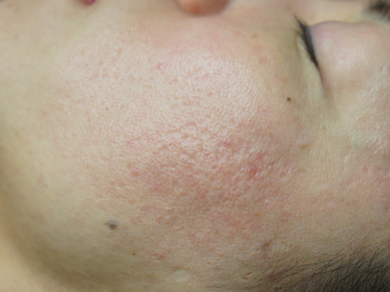 質問日時の新しい順 スキンケア 回答受付中の質問 - Yahoo!知恵袋