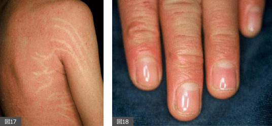 そのかゆみ、ストレスが原因かも！かゆみを抑える方法や予防法も紹介肌育研究所