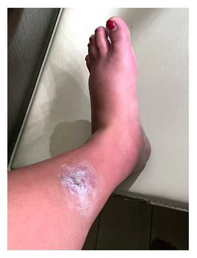 蚊よりも強烈！真夏の夜釣りで襲われた小さな虫の正体とは ？ なるフィッシュ- エキスパート - Yahoo!ニュース