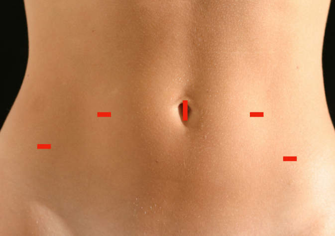 八雲総合病院 - 手術写真