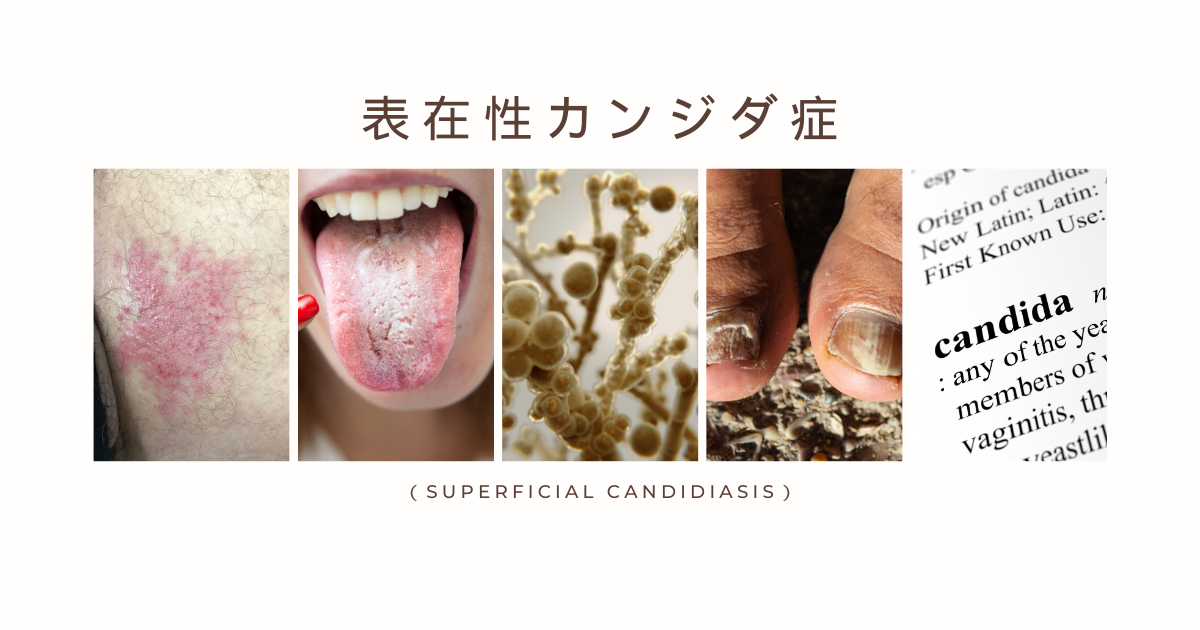 口腔カンジダ症初めまして。川内歯科医院です *'▽'