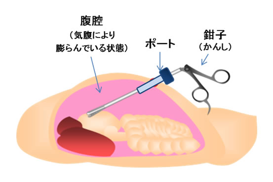 コロナから復帰のトミーズ雅が中等症の肺炎「コロナ陽性４日後から」 - スポーツ報知