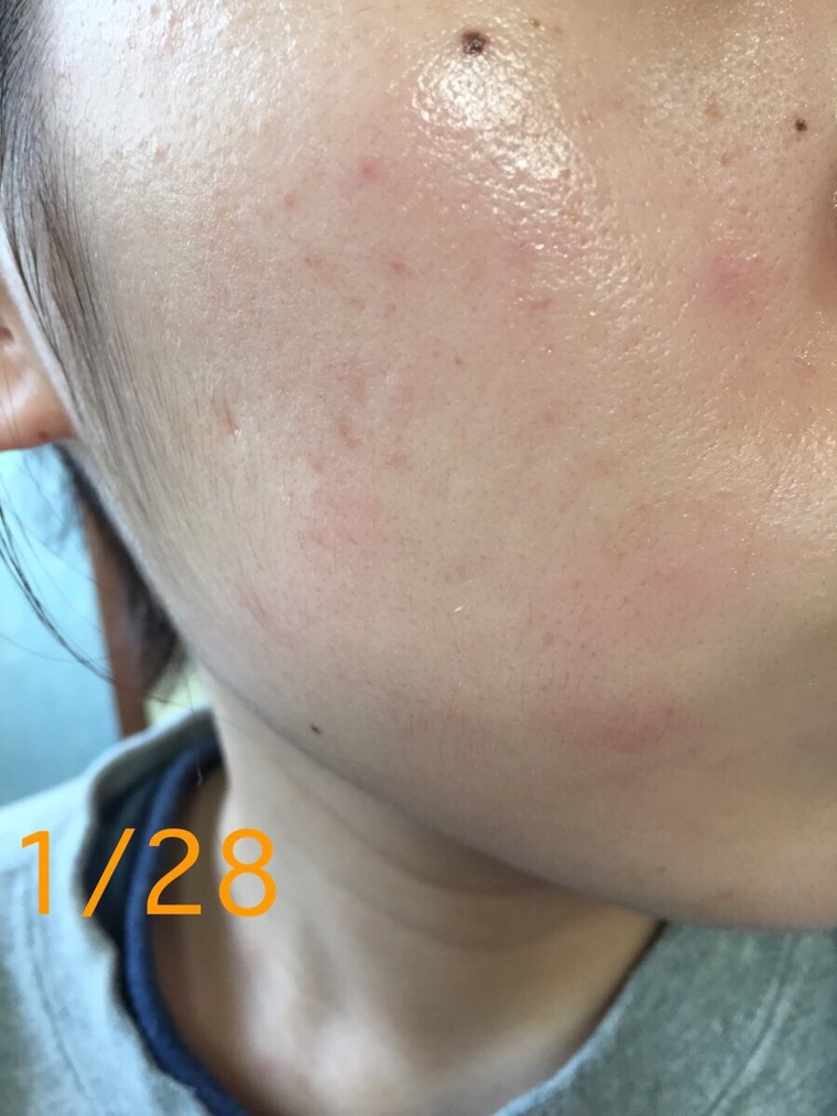 肌断食一ヶ月経ちました。 - はにログ◎シンプルをほどよく楽しむ