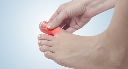 痛風 東京・杉並・中野・練馬・西東京 杉並区で内科・下肢静脈瘤の治療なら下井草駅徒歩3分の杉並すだクリニック