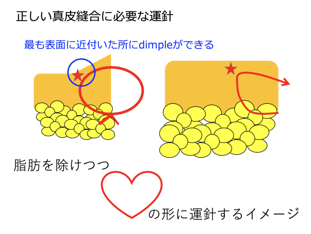 手技手順PLUS CHUGAI 中外製薬医療関係者向けサイト 医師向け