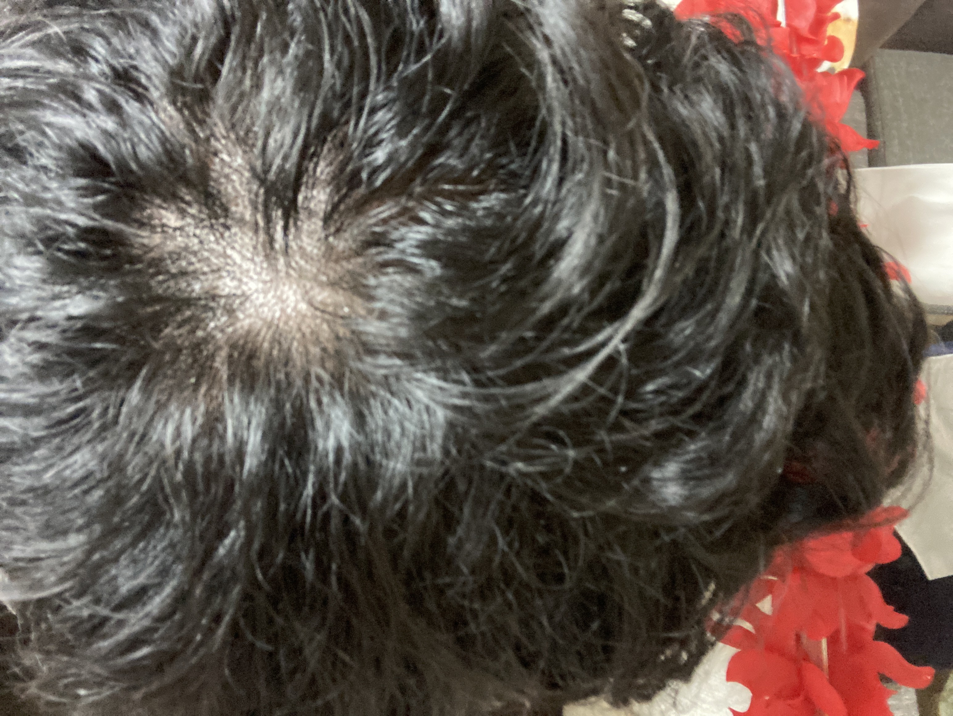 AGA 頭頂部がはげたらどうする？つむじハゲの原因と対策を紹介 - トラブルブック