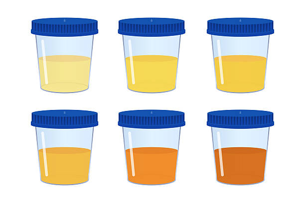 尿検査のアイコン 線画カラー の無料イラスト透過PNG・商用利用OKイラストセンタ