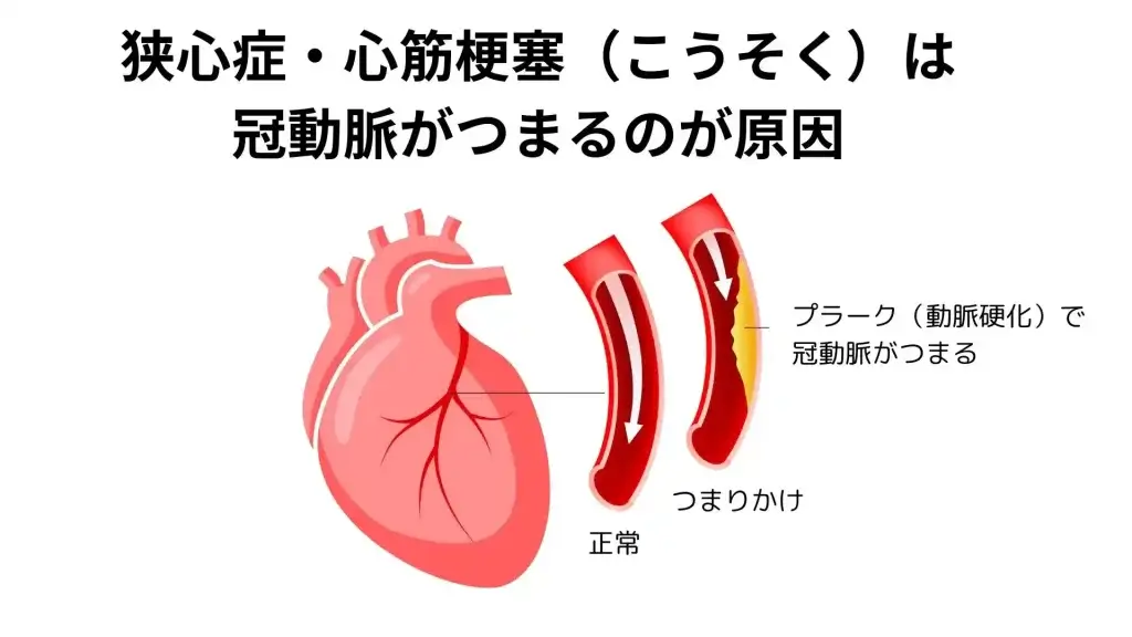 胸が痛くなる病気・検査名古屋おもて内科・呼吸器内科クリニック荒畑駅・御器所駅