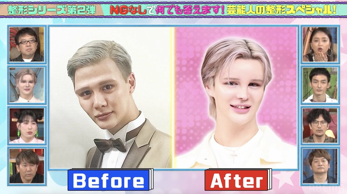 Matt、美容整形のビフォーアフターを披露「昔は家に帰るとパパが腰抜かしてた」バラエティABEMA TIMESアベマタイムズ