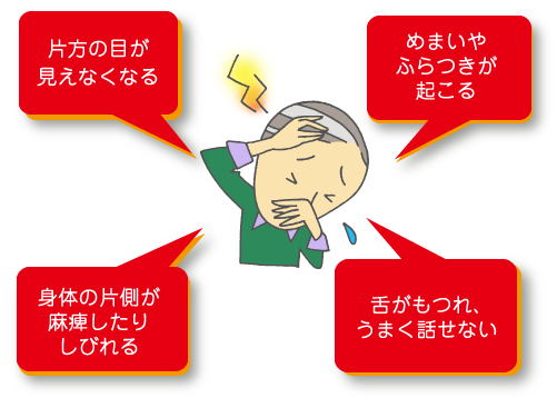 リハビリ 女優 河合美智子さん『小走り』目標・改善プログラム６回目〜鍼灸で顔のリフトアップ！〜@noureha​