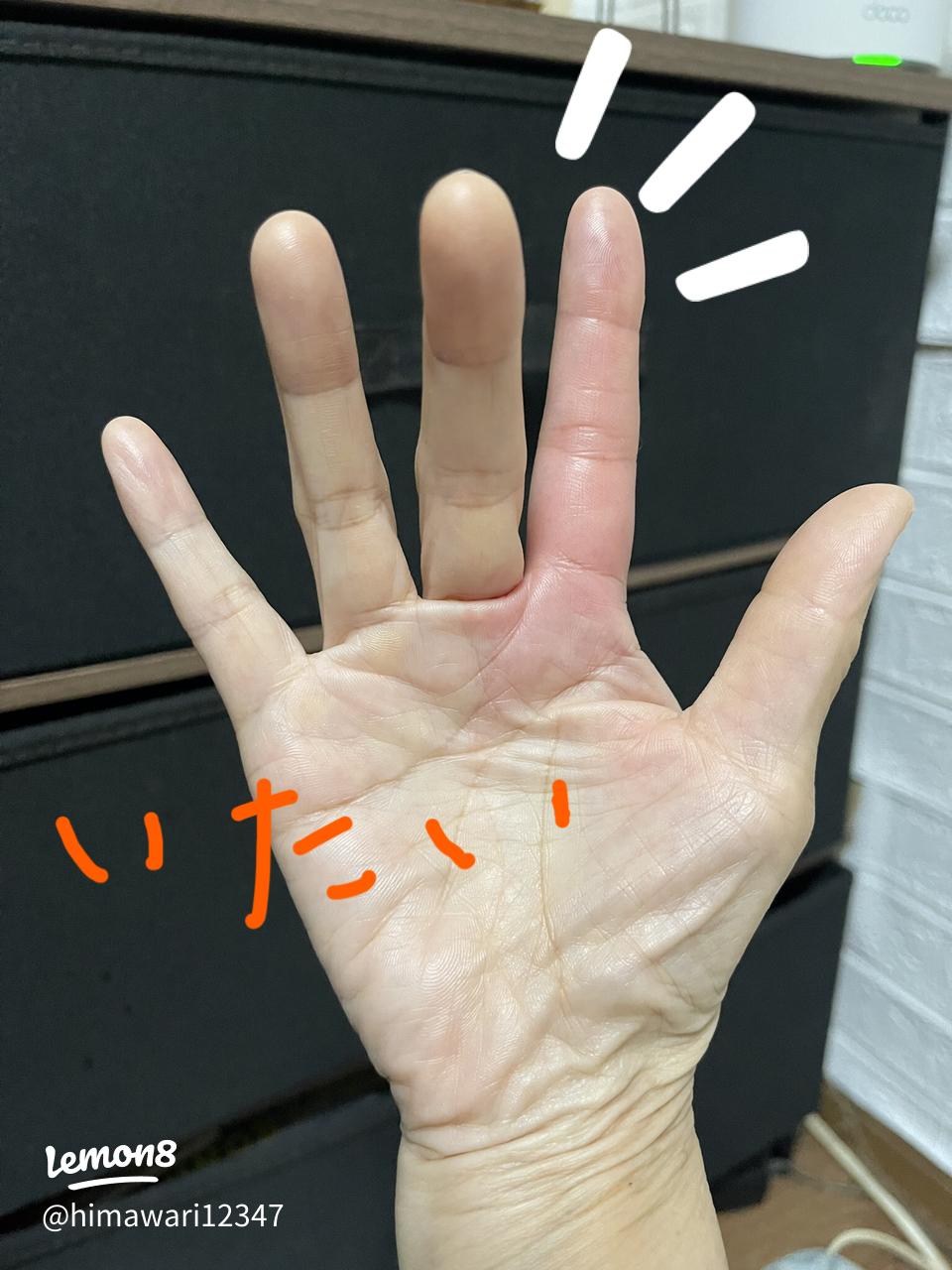 ムカデに噛まれたら放置しても大丈夫なの！？ 毒の成分と凶暴な種類神奈川県の駆除専門業者クリーン計画プロープル