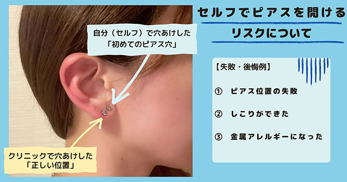 正しいピアッシングのための基礎知識:大切なアフターケアJPS株式会社