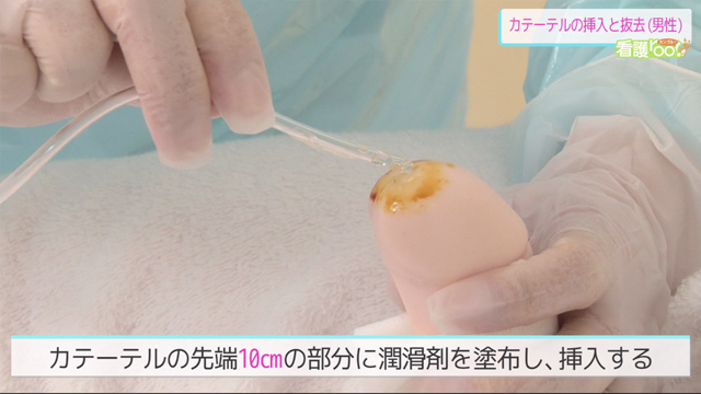 自己導尿の目的とは？カテーテルとの違いや男女別の手順を解説