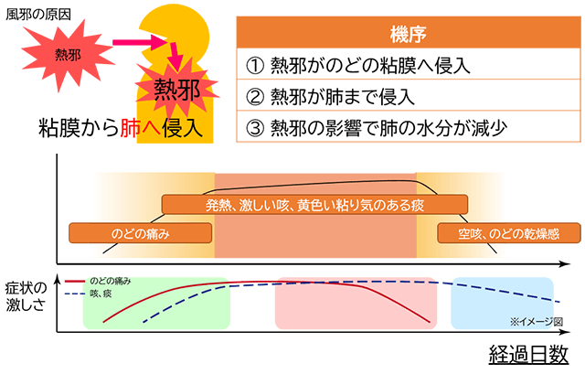 のどの痛み・違和感を起こす感染症は？内科総合クリニック人形町