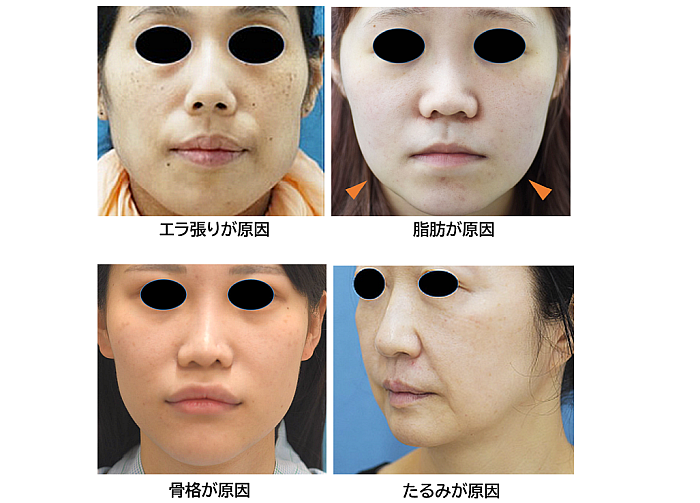 顔が大きいメンズでも小顔効果抜群！？骨格に合わせて髪型をチョイス！ - me ns エムイー エヌエス