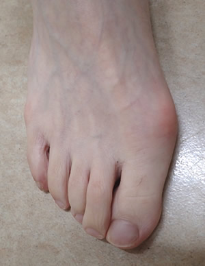 これでわかる！痛風教室痛風・人工透析なら東京都墨田区の両国東口クリニック