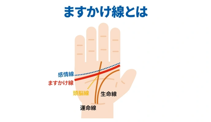 ますかけ線とは？基本の意味や見方、珍しい変形タイプも詳しく解説日本メディカル心理セラピー協会 JAAMP