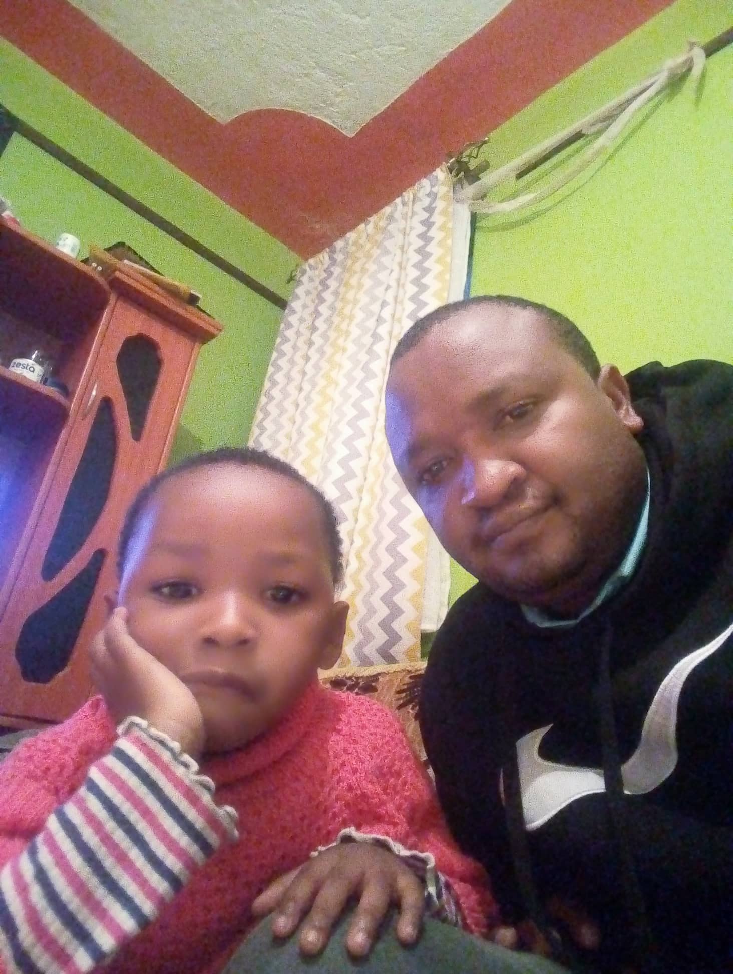 飢餓になると逆にお腹が膨らむ？クワシオルコルとは？エピネシス