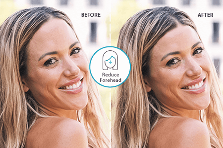 額縮小術 公式 アテナクリニック東京銀座の美容整形外科