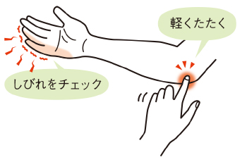 手がしびれる病気は？前兆とチェックを医師が解説リペアセルクリニック東京院