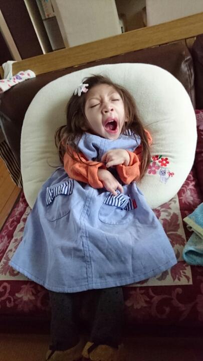 小頭症笑顔をもう一度