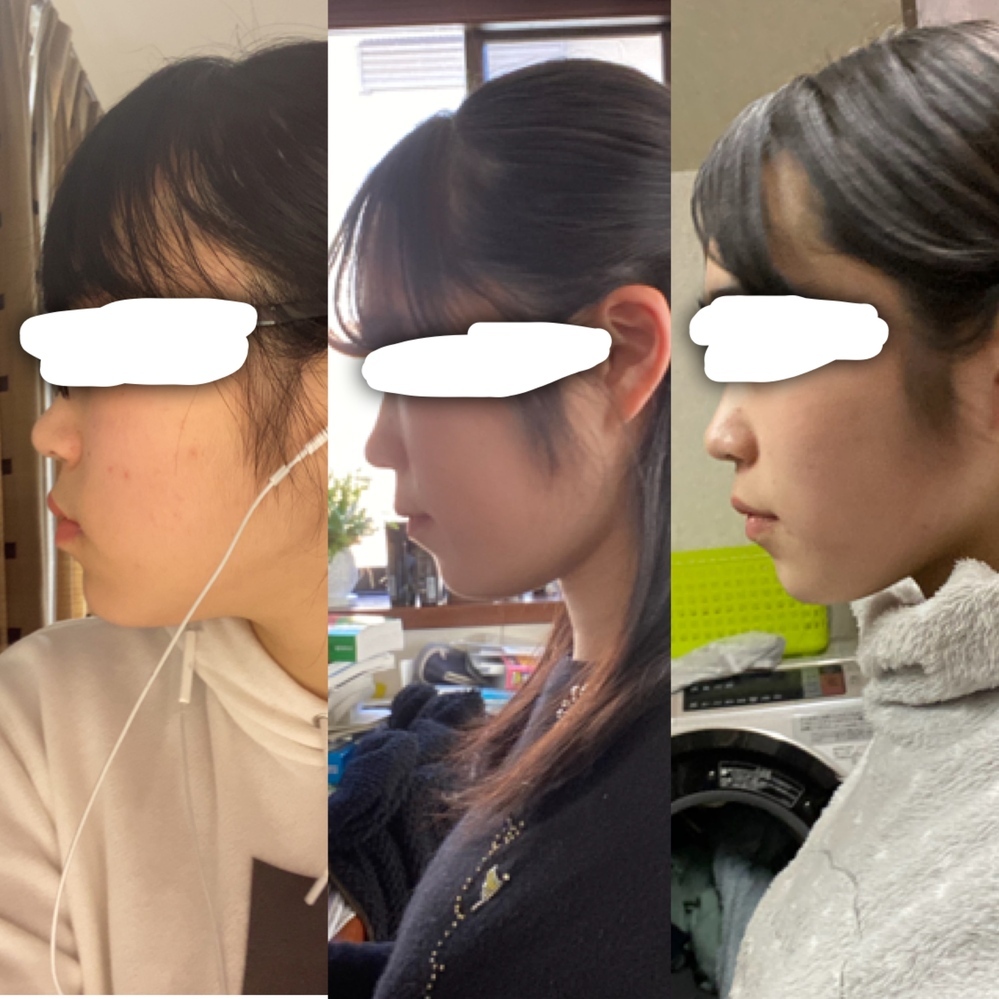 顔痩せ筋トレ３選 すぐに実践できる効果的なマッサージ方法とは？パーソナルトレーニング・完全個室パーソナルジムならかたぎり塾