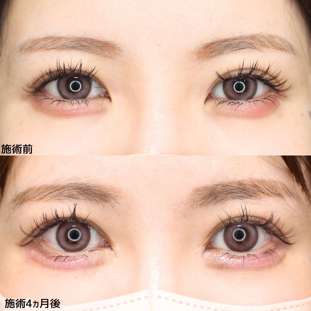 アーモンドアイメイクのやり方。まぶたの形に合った雰囲気が大切