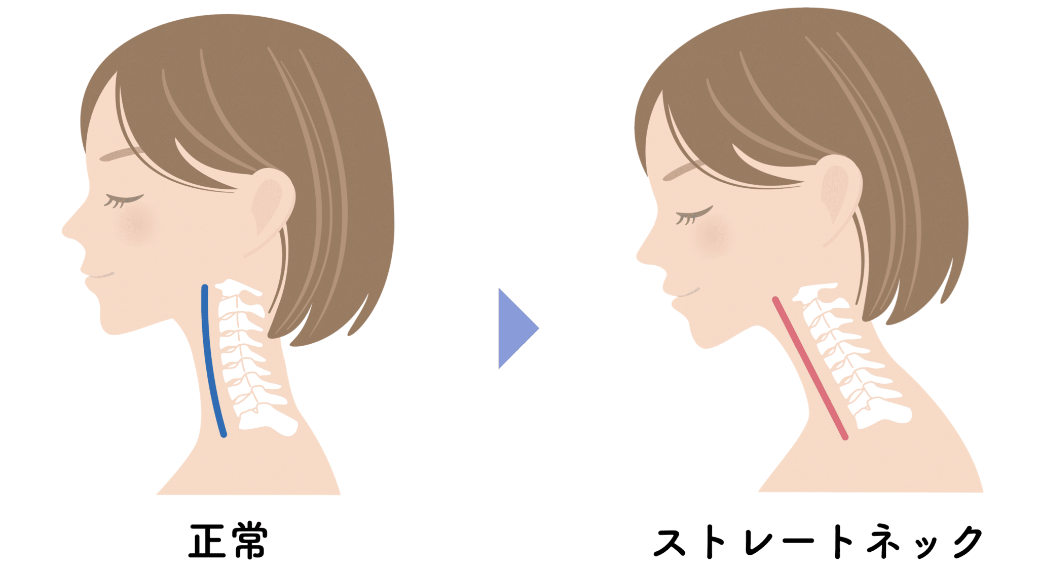 断面図 人体の写真素材 - PIXTA