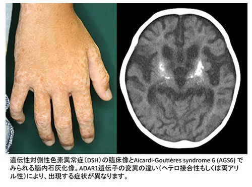 15,000点を超える色素脱失のストックフォト、写真、そしてロイヤリティフリーの画像 - iStock