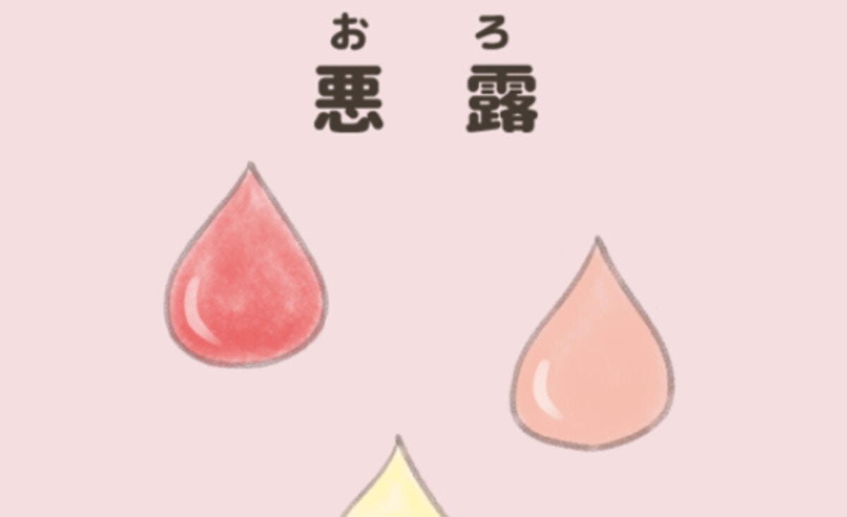 産後6週間 悪露が止まらない！先生の診断は産褥期なめちゃダメ③ by chiikoすくパラNEWS